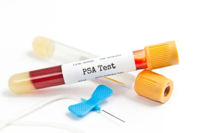 PSA co to za badanie? Kluczowe informacje o zdrowiu prostaty PSA co to za badanie? Kluczowe informacje o zdrowiu prostaty